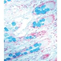 Diagnostic Biosystems