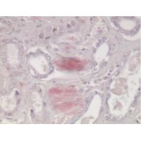 Diagnostic Biosystems