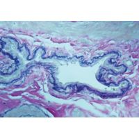 Diagnostic Biosystems