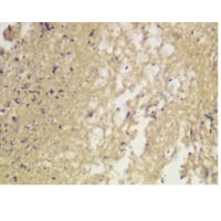 Diagnostic Biosystems