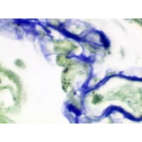 Diagnostic Biosystems