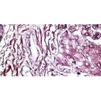 Diagnostic Biosystems