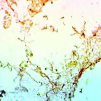 Diagnostic Biosystems