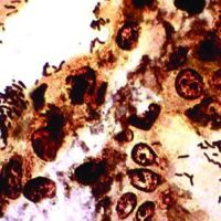 Diagnostic Biosystems